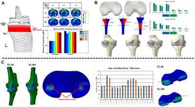 Application strategy of finite element analysis in artificial knee arthroplasty